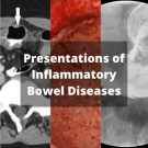 bowel disease