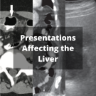 Presentations Affecting the Liver
