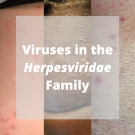 herpesviridae family