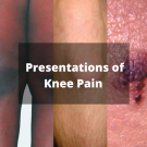 knee pain