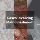 Cases Involving Malnourishment