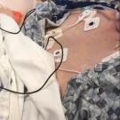 Still photo of Breathless After Cardiopulmonary Resuscitation: How Would You Diagnose This Patient’s Respiratory Pattern?