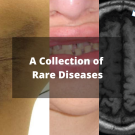 A collection of rare diseases