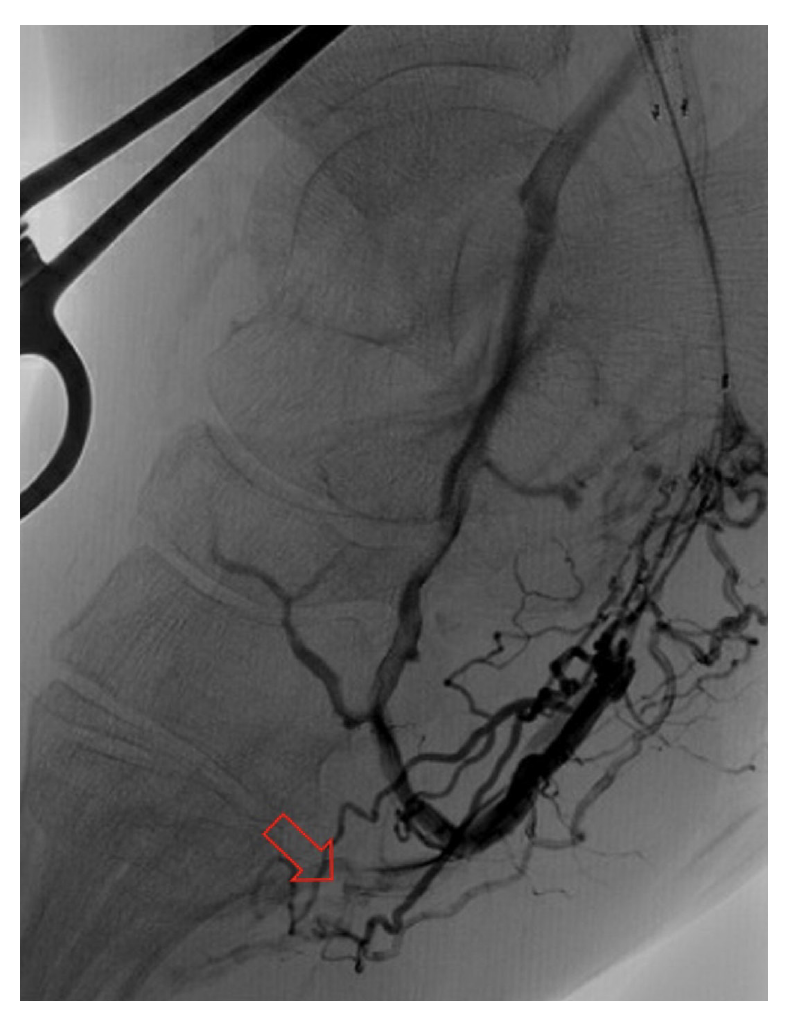 Zaman Figure 5