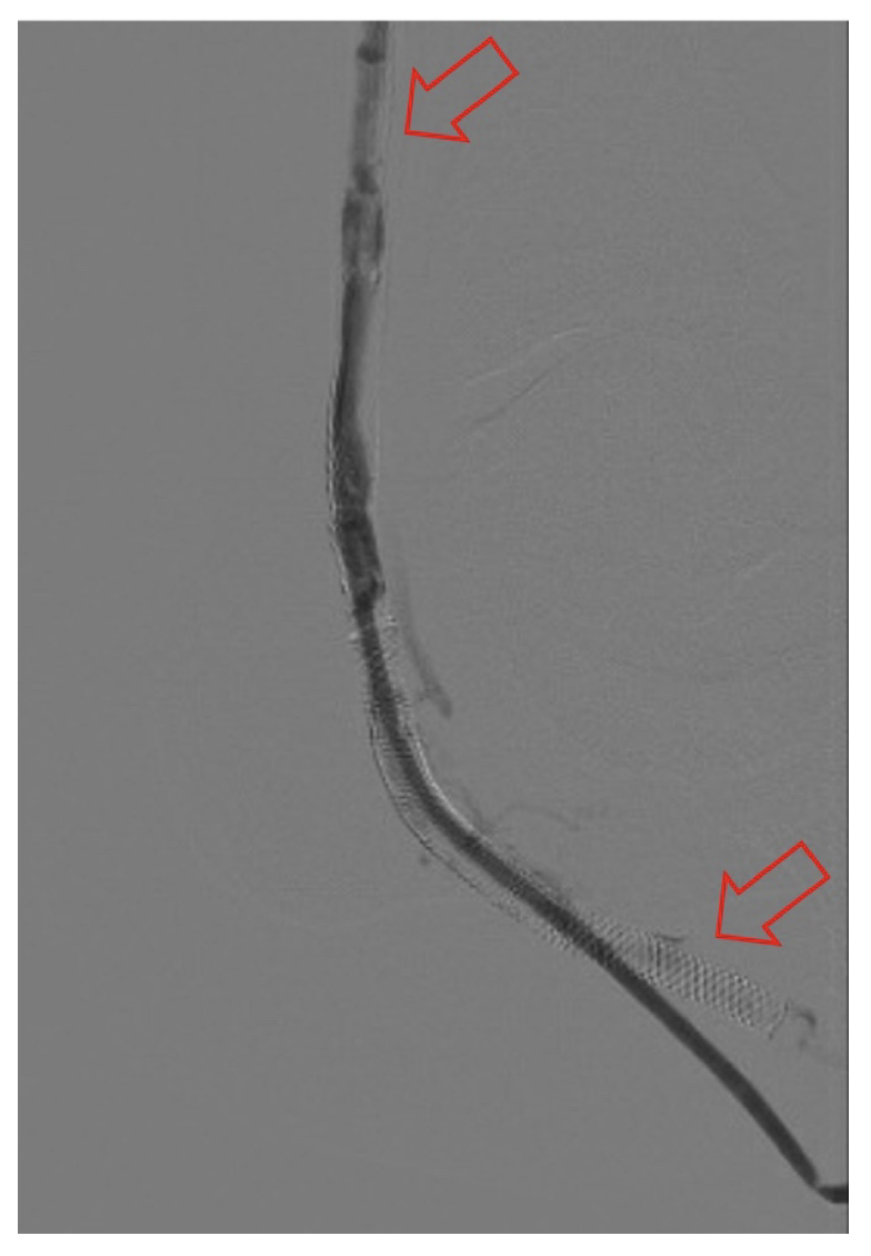 Zaman Figure 6