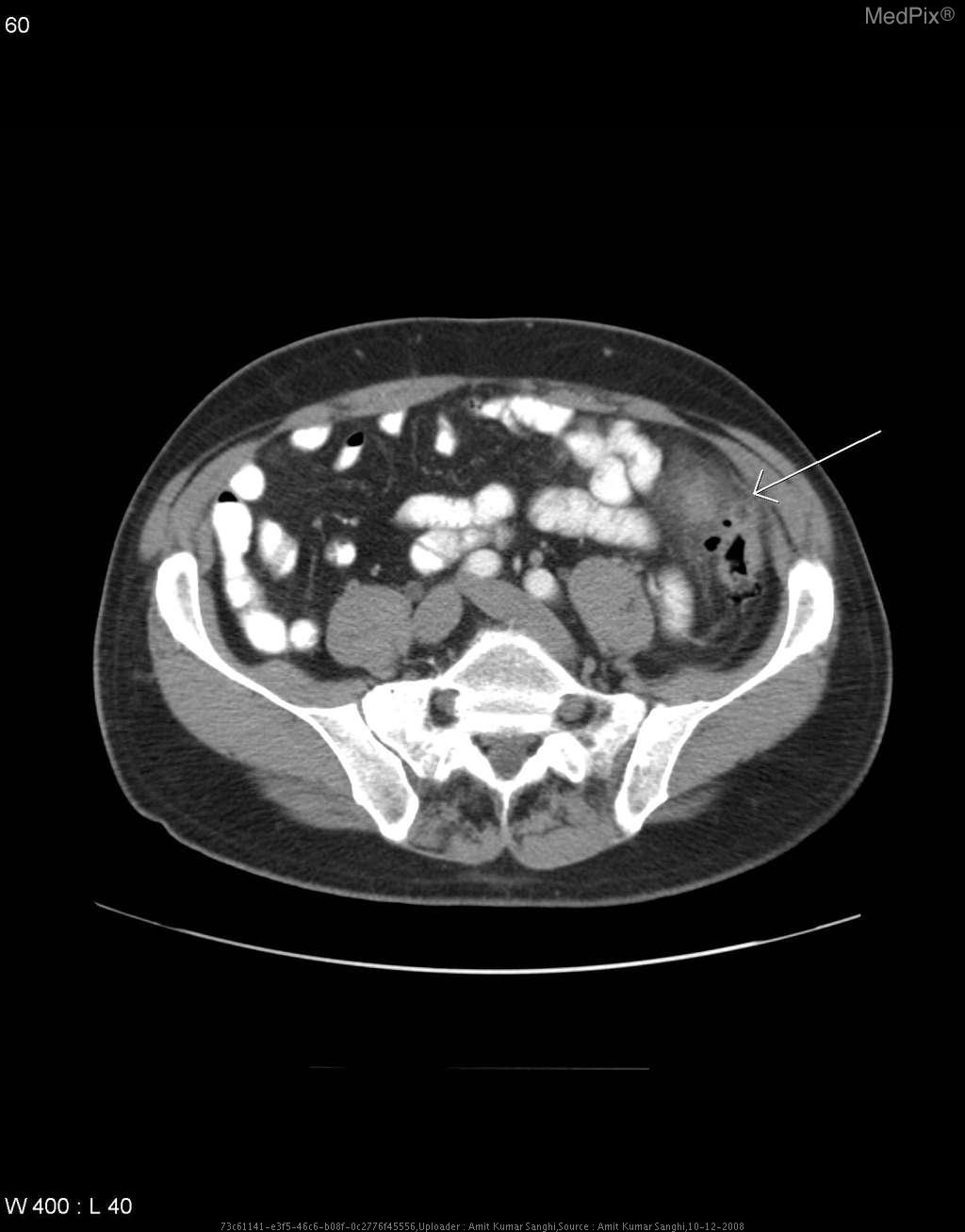 Colorectal Diseases and Disorders Topic Center Gastroenterology