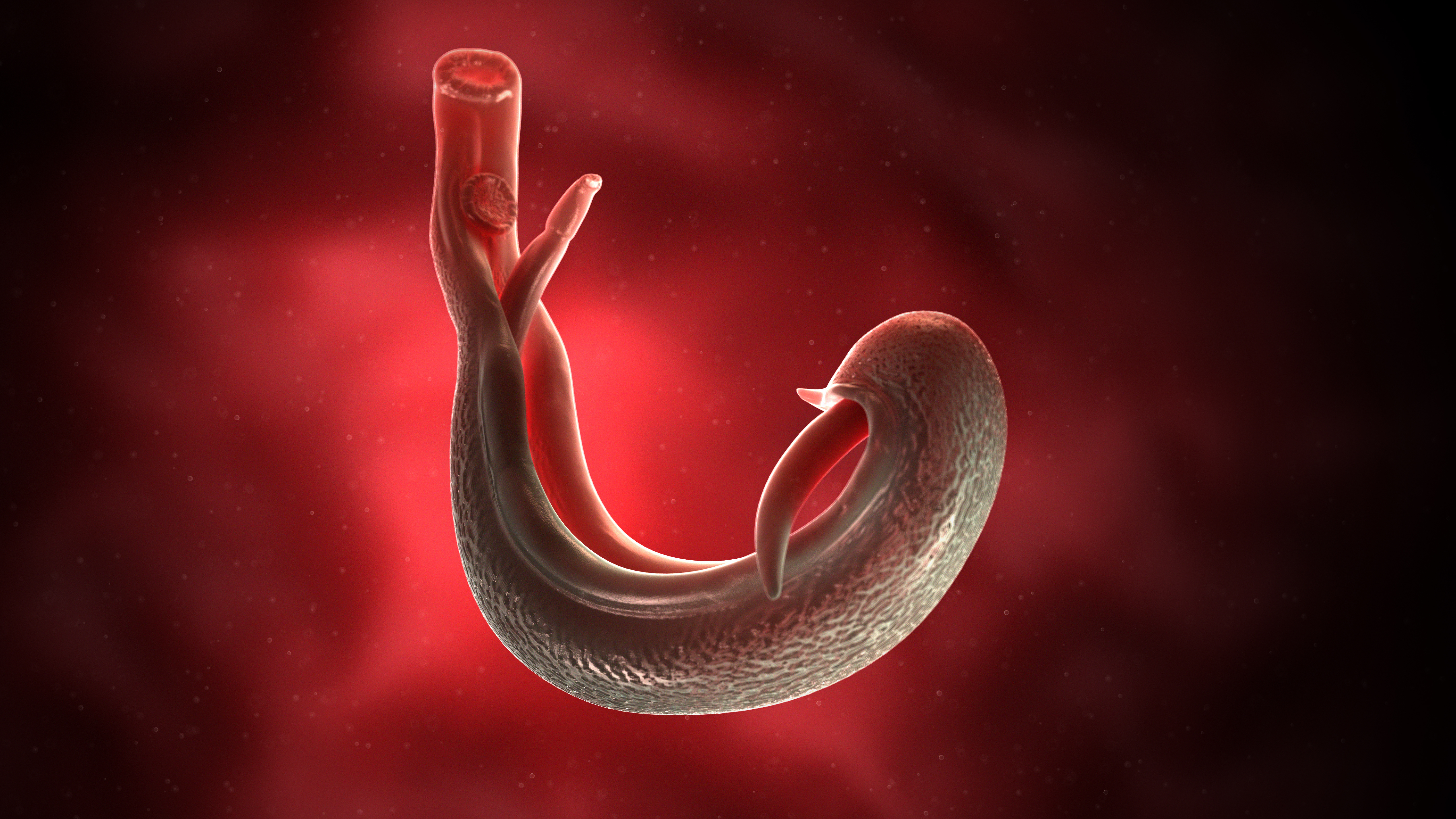 schistosomiasis