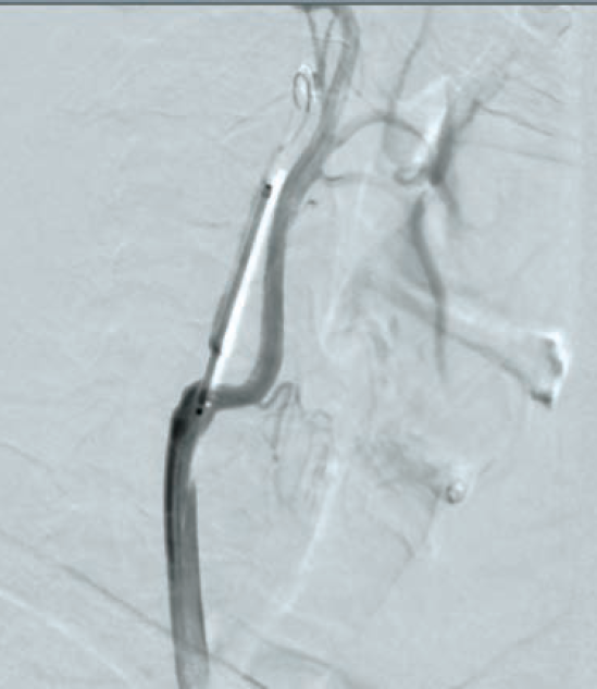 Anjum-Fig 3-CLD-Aug 2025.png 
