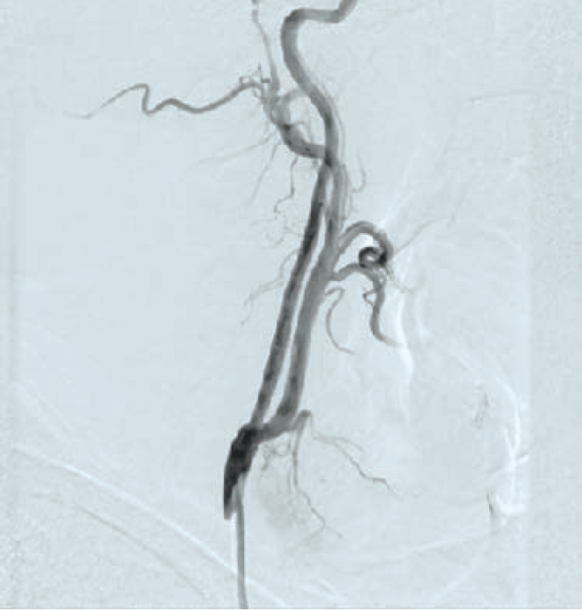 Anjum-Fig 8a-CLD-Aug 2025.png 