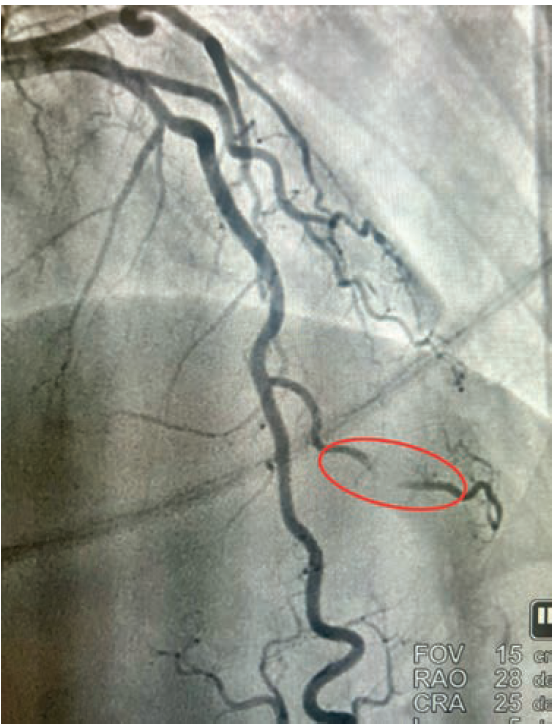 Casazza Figure 1