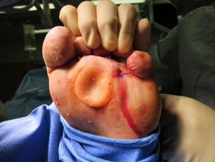 Intraoperative image