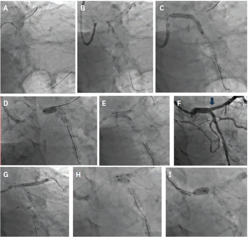 Sahoo,-Fig3-CLD-Sept 2025.png 