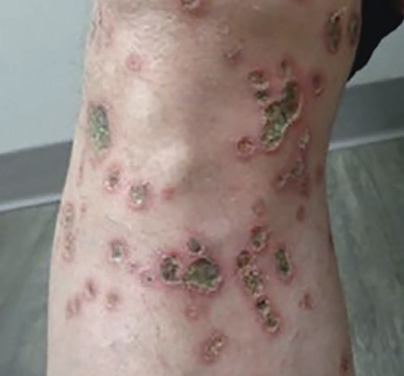 derm dx august