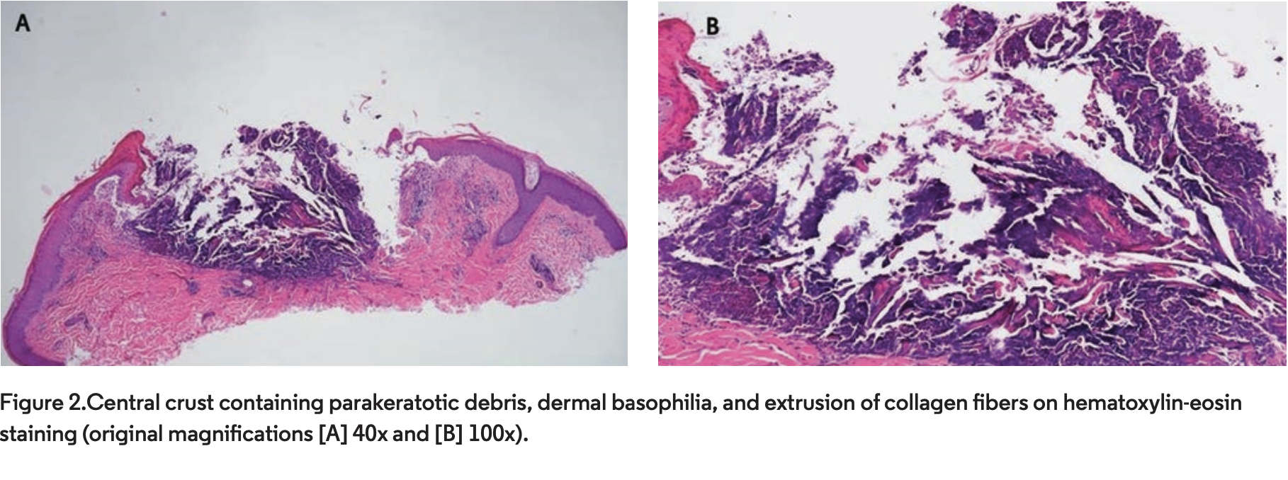 august derm dx