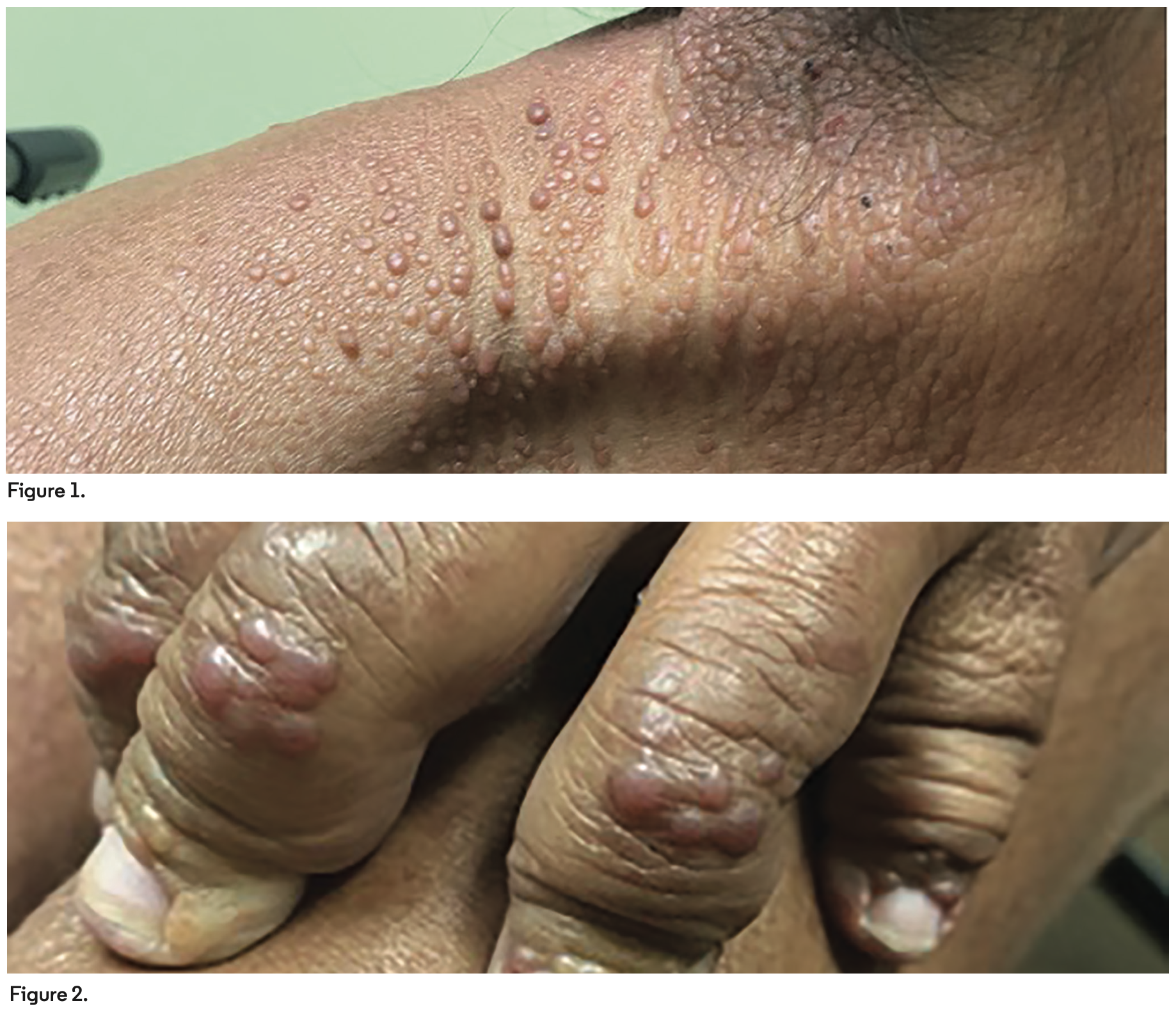 March 2022 - Derm Dx