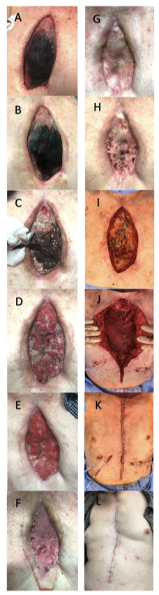 Figure 11