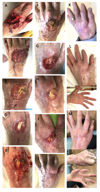 Figure 13