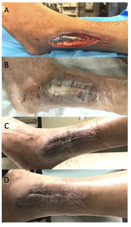 Figure 16