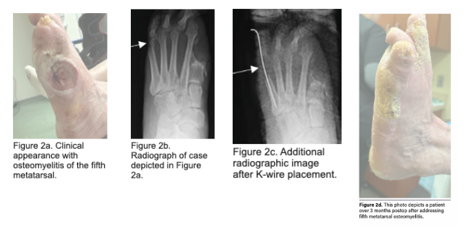 figs 2