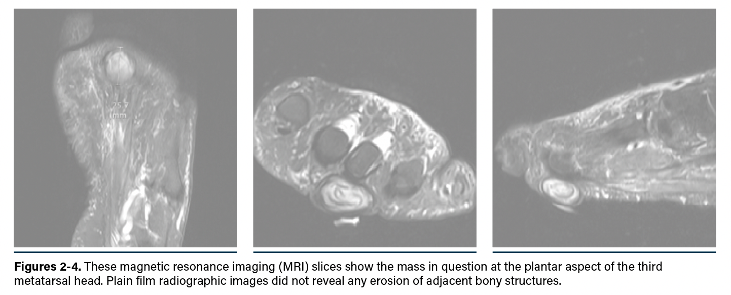 Imaging