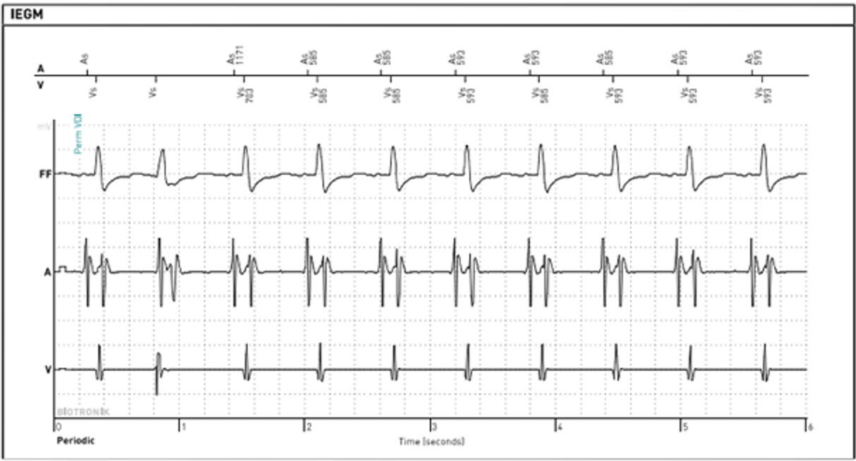 fig b1