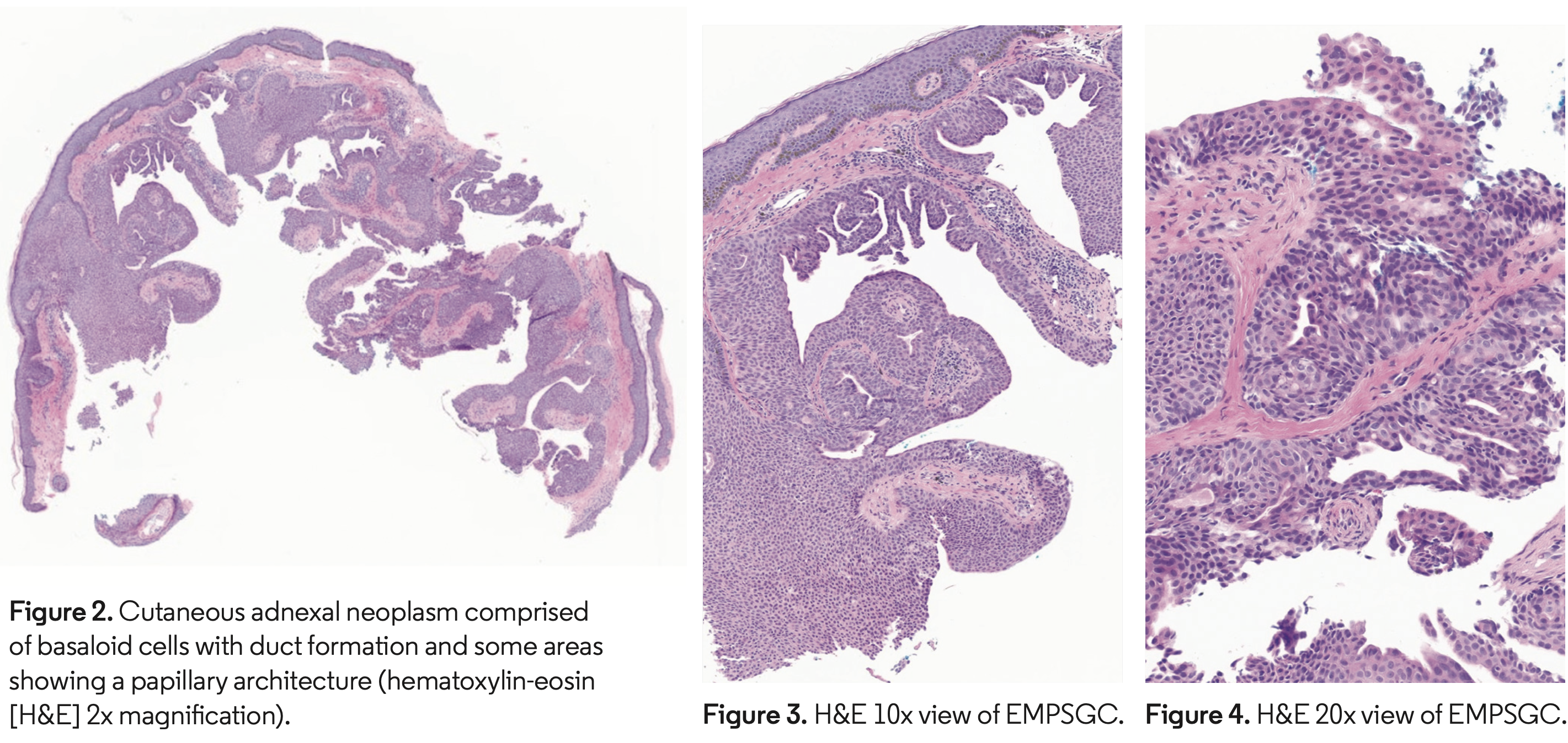 fig 2-4