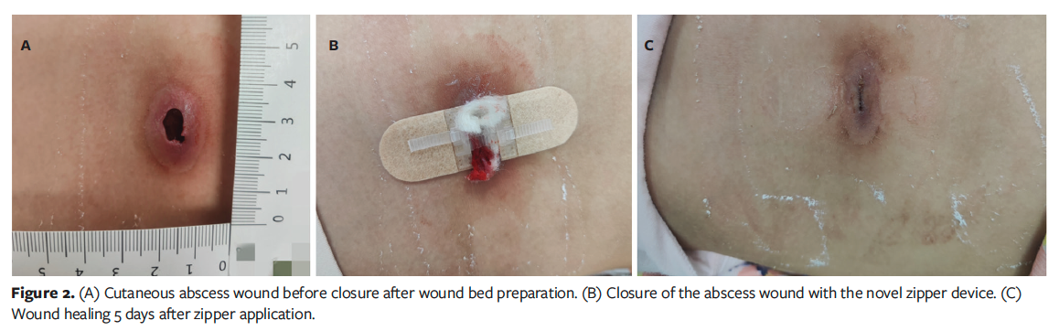 Figure 2