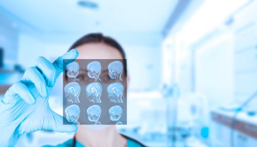 Dr looking at brain scans