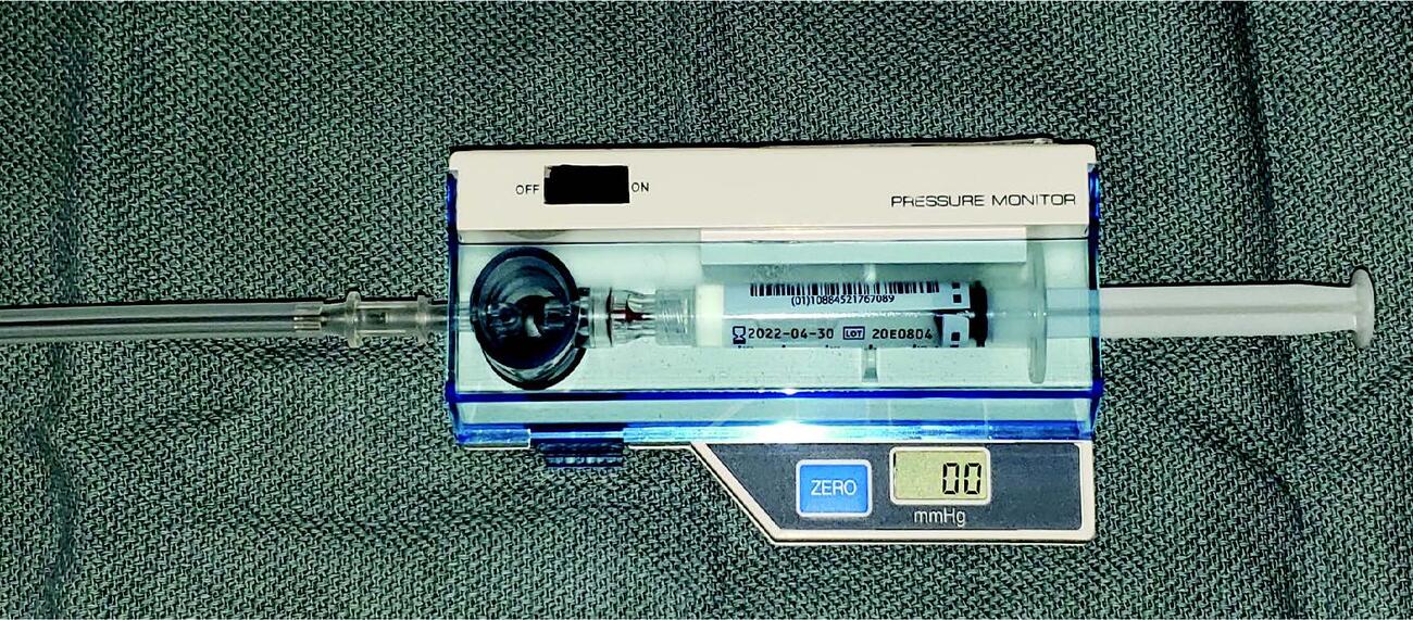 ExerciseInduced Compartment Syndrome And Athletes