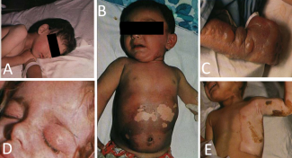Figure 2 of article