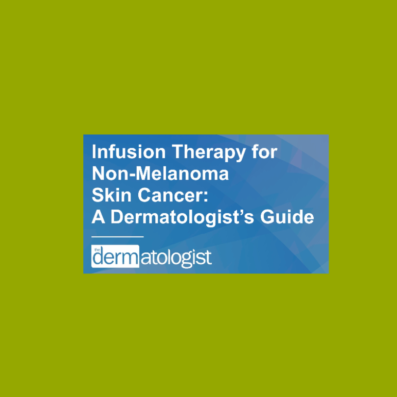 Infusion Therapy for Non-Melanoma Skin Cancer
