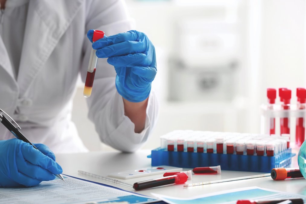 Serologies and Autoimmune Testing in Dermatologic Disease 