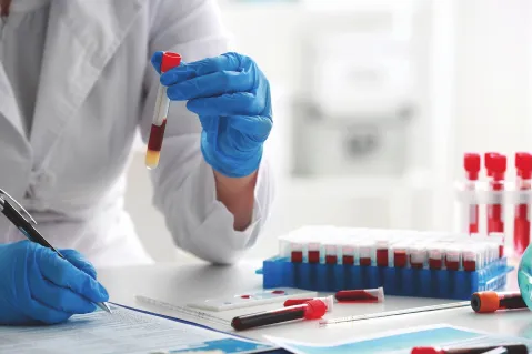 Serologies and Autoimmune Testing in Dermatologic Disease 