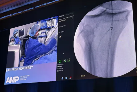 Live Case